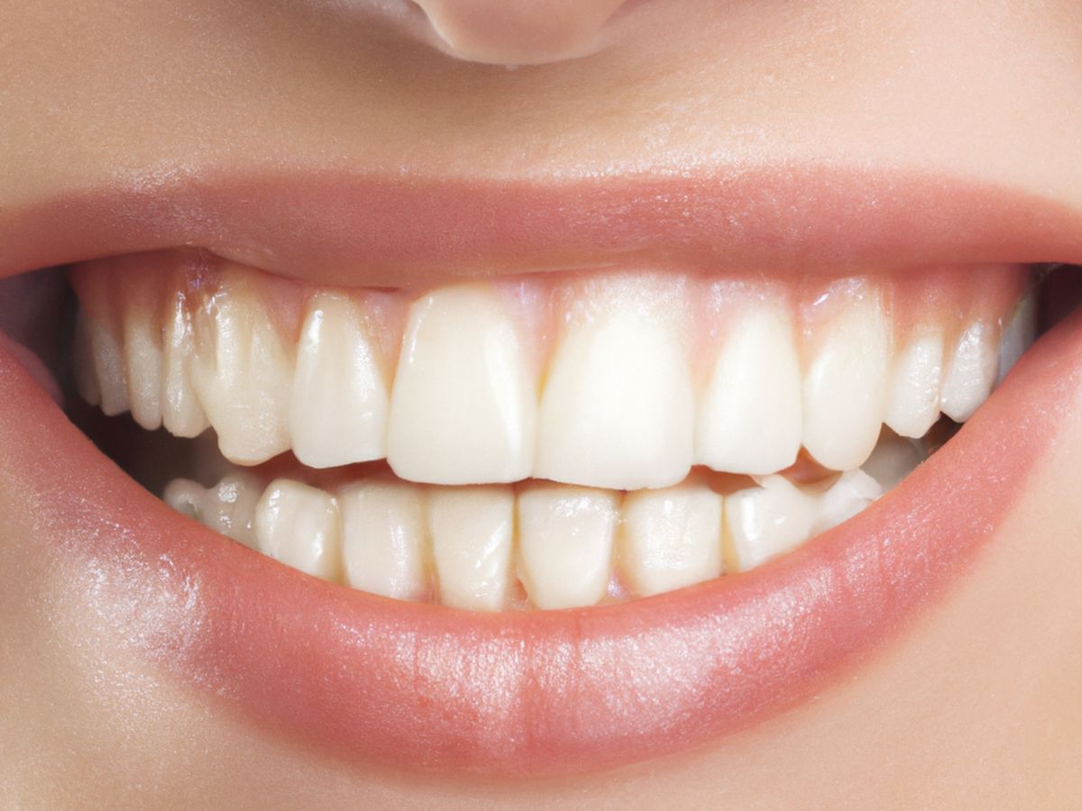 SNOW Teeth Whitening Kit